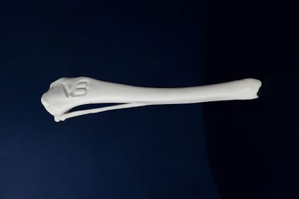 استخوان درشت نی و نازک نی سگ