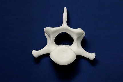 استخوان مهره 7 پشتی سگ